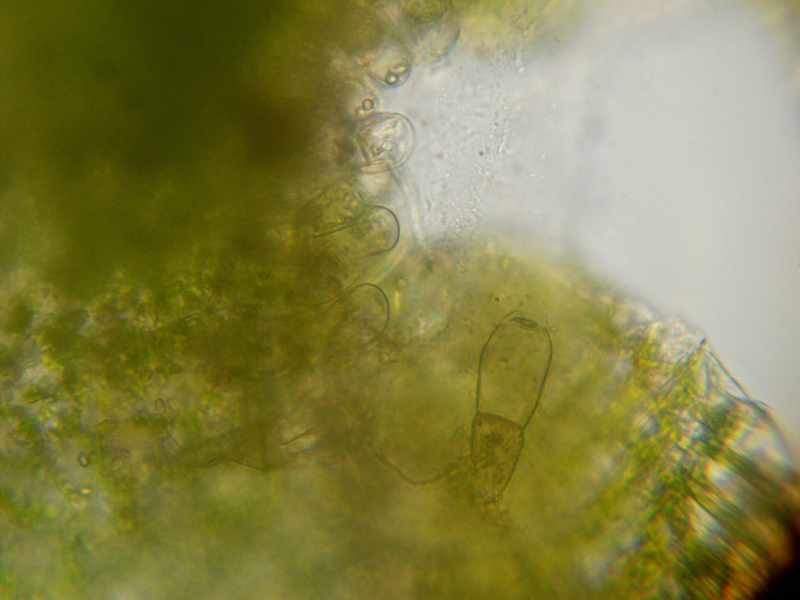 Pellia neesiana